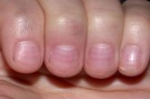 Полумесяцем или с уголками: как правильно стричь ногти?